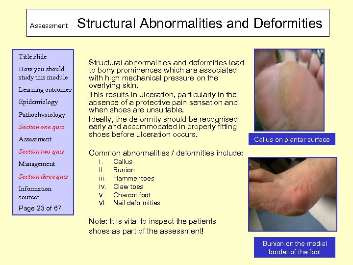 Assessment Title slide How you should study this module Learning outcomes Epidemiology Pathophysiology Section