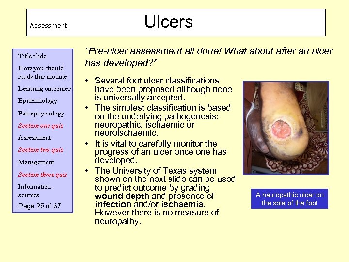 Assessment Title slide How you should study this module Learning outcomes Epidemiology Pathophysiology Section