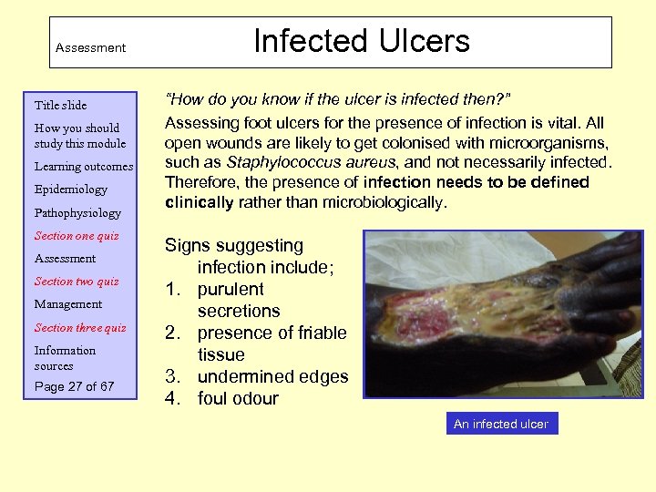 Assessment Title slide How you should study this module Learning outcomes Epidemiology Pathophysiology Section