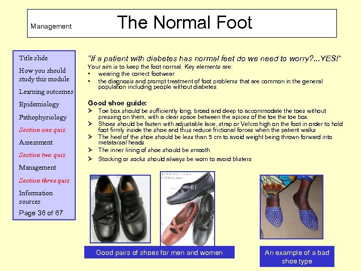 Management The Normal Foot Title slide “If a patient with diabetes has normal feet