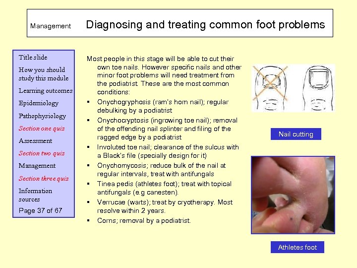 Management Title slide How you should study this module Learning outcomes Epidemiology Pathophysiology Section