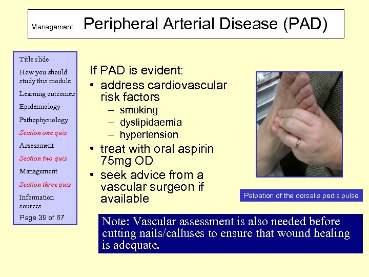 Management Peripheral Arterial Disease (PAD) Title slide How you should study this module Learning