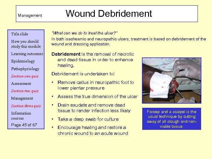 Management Title slide How you should study this module Learning outcomes Epidemiology Pathophysiology Section
