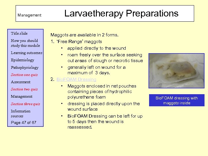 Management Title slide How you should study this module Learning outcomes Epidemiology Pathophysiology Section