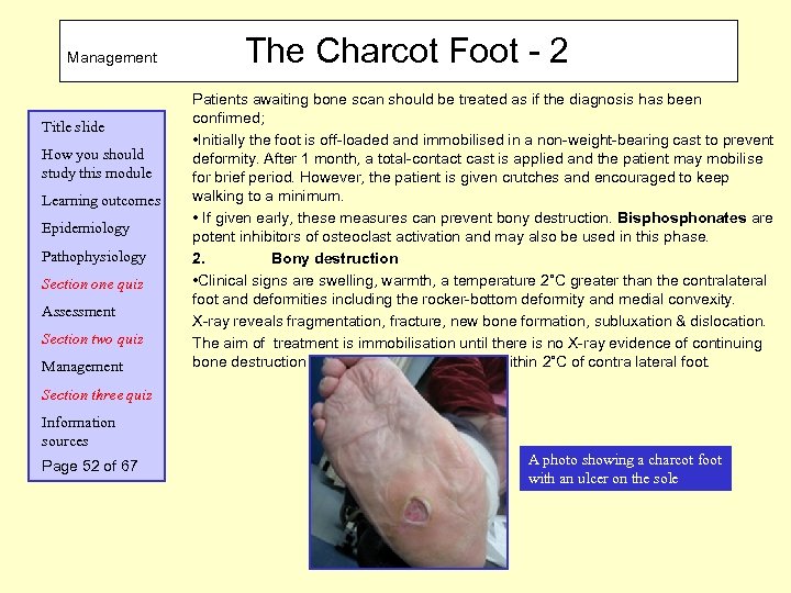 Management Title slide How you should study this module Learning outcomes Epidemiology Pathophysiology Section