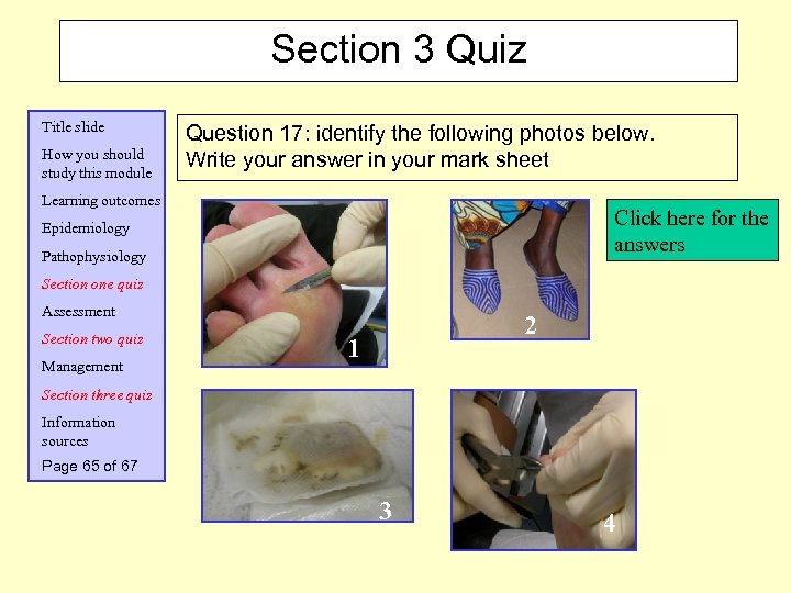 Section 3 Quiz Title slide How you should study this module Question 17: identify
