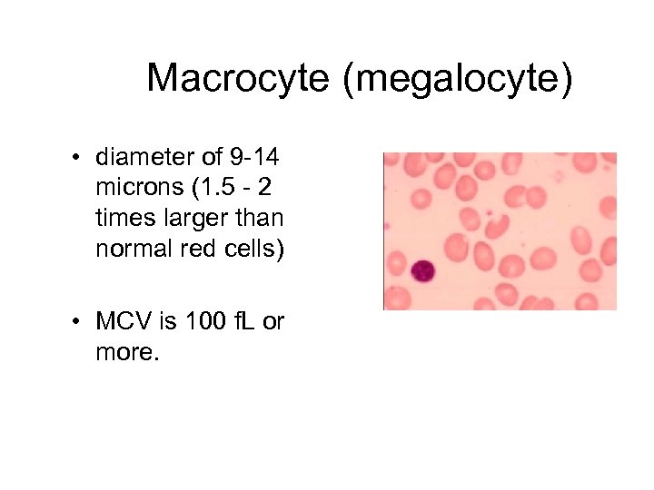 Macrocyte (megalocyte) • diameter of 9 -14 microns (1. 5 - 2 times larger