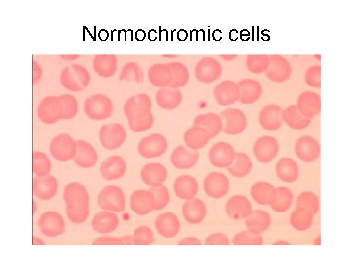 Normochromic cells 