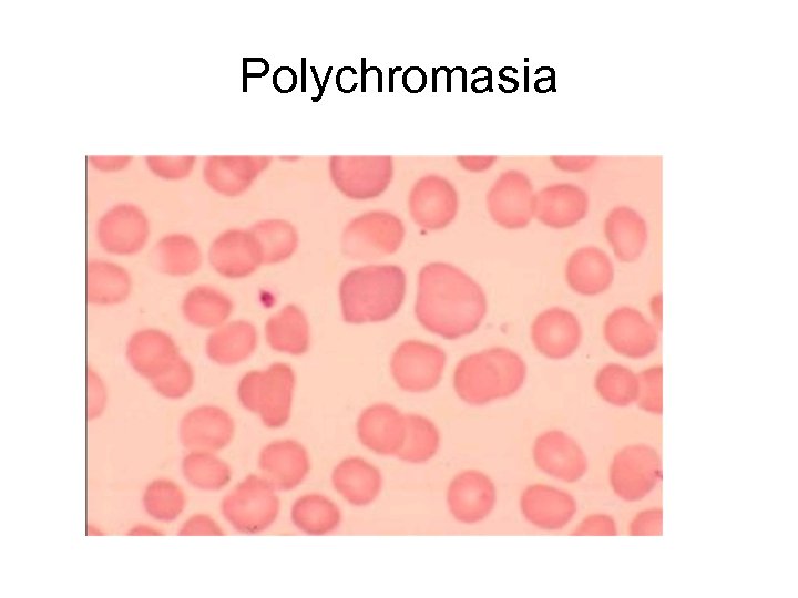 Polychromasia 