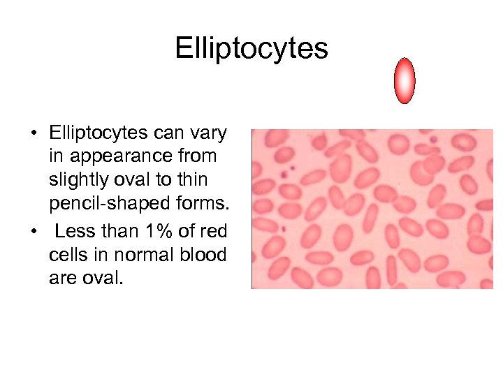 Elliptocytes • Elliptocytes can vary in appearance from slightly oval to thin pencil-shaped forms.