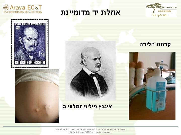  אוזלת יד מדומיינת קדחת הלידה איגנץ פיליפ זמלווייס Arava EC&T LTD. Arava Institute