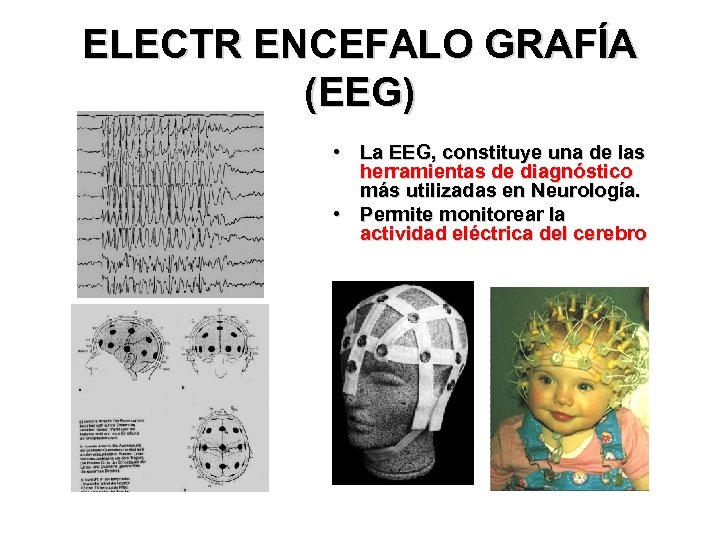 ELECTR ENCEFALO GRAFÍA (EEG) • La EEG, constituye una de las herramientas de diagnóstico