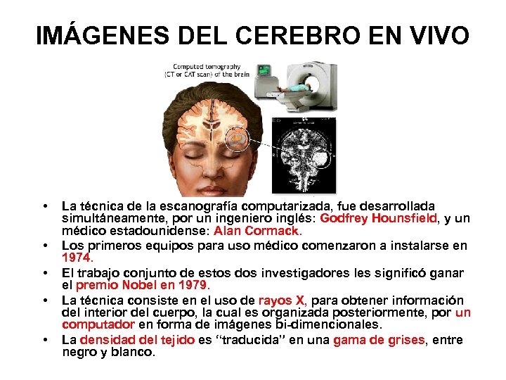 IMÁGENES DEL CEREBRO EN VIVO • • • La técnica de la escanografía computarizada,