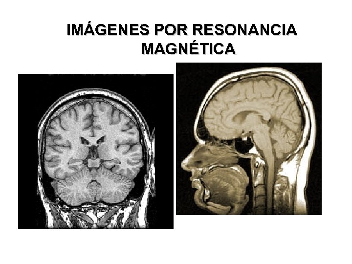 IMÁGENES POR RESONANCIA MAGNÉTICA 