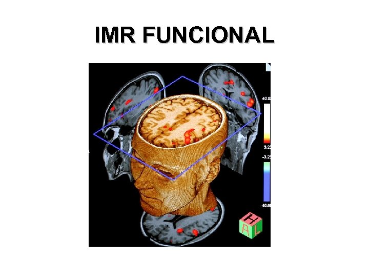 IMR FUNCIONAL 