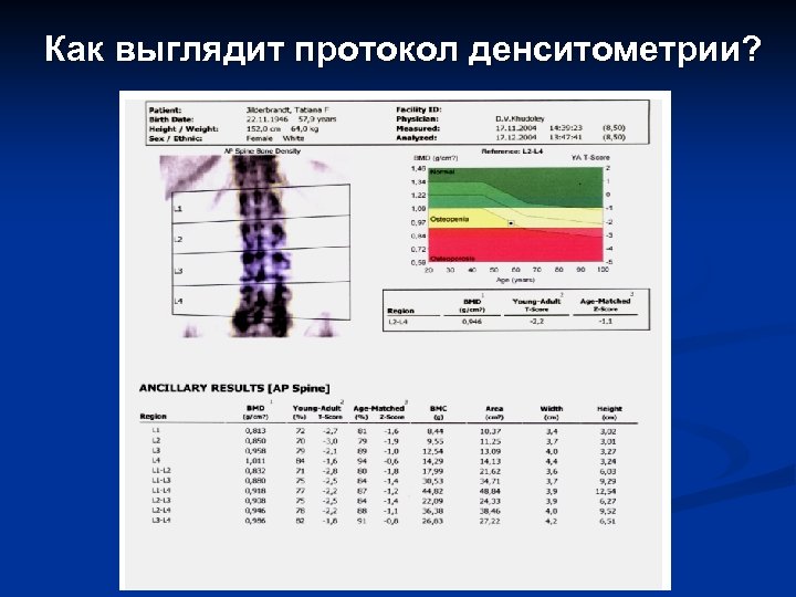 Денситометрия в твери