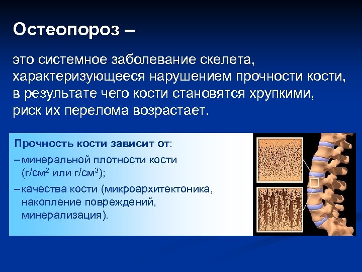 Остеопороз – это системное заболевание скелета, характеризующееся нарушением прочности кости, в результате чего кости