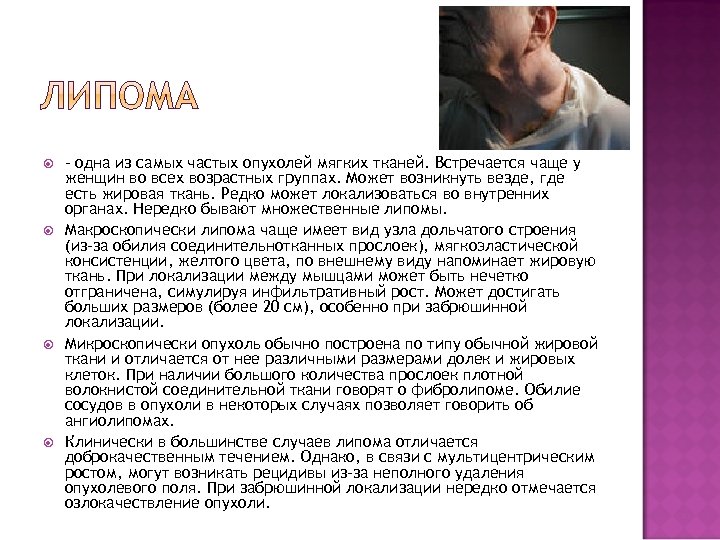  – одна из самых частых опухолей мягких тканей. Встречается чаще у женщин во