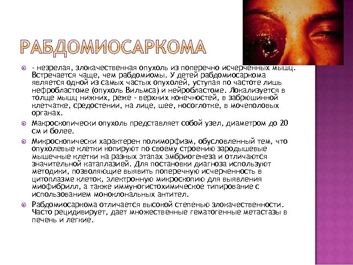  – незрелая, злокачественная опухоль из поперечно исчерченных мышц. Встречается чаще, чем рабдомиомы. У
