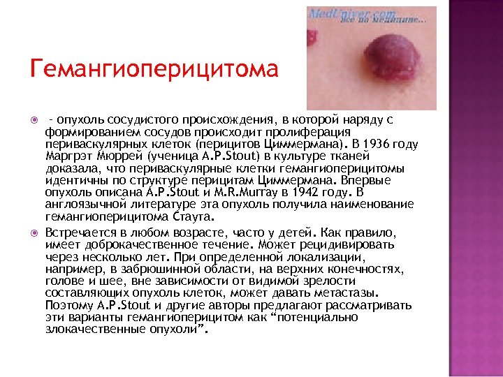 Гемангиоперицитома – опухоль сосудистого происхождения, в которой наряду с формированием сосудов происходит пролиферация периваскулярных