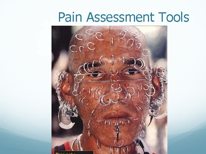 Pain Assessment Tools 