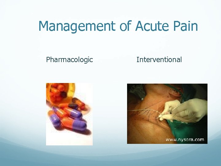 Management of Acute Pain Pharmacologic Interventional 