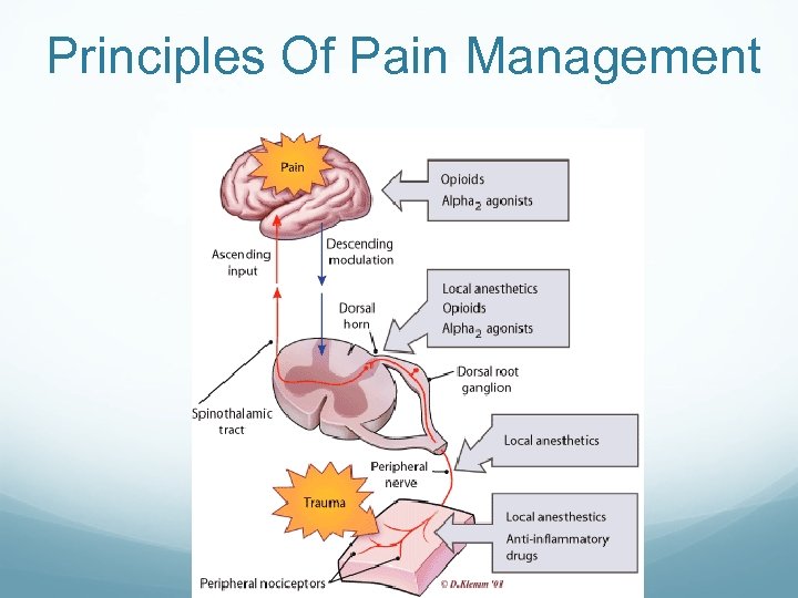 Principles Of Pain Management 