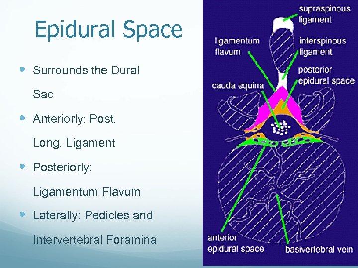 Epidural Space Surrounds the Dural Sac Anteriorly: Post. Long. Ligament Posteriorly: Ligamentum Flavum Laterally: