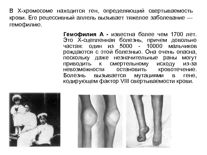 В Х-хромосоме находится ген, определяющий свертываемость крови. Его рецессивный аллель вызывает тяжелое заболевание —