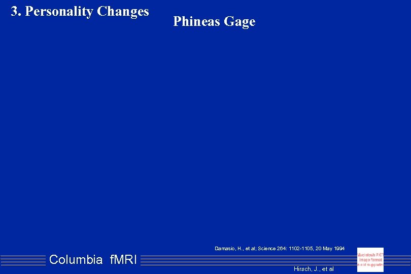 3. Personality Changes Phineas Gage Damasio, H. , et al; Science 264: 1102 -1105,