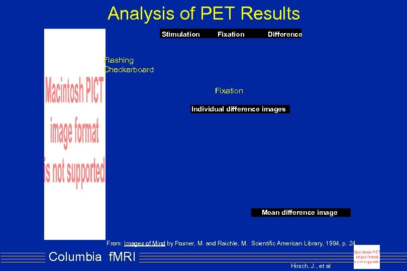 Analysis of PET Results Stimulation Fixation Difference Flashing Checkerboard Fixation Individual difference images Mean