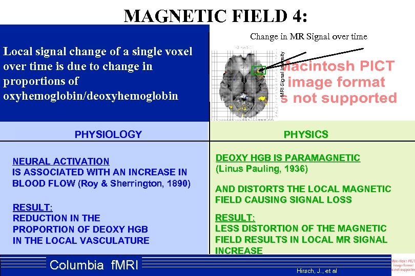 MAGNETIC FIELD 4: Local signal change of a single voxel over time is due