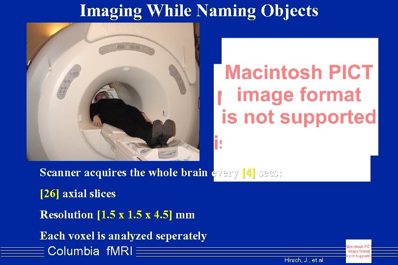 Imaging While Naming Objects Scanner acquires the whole brain every [4] secs: [26] axial