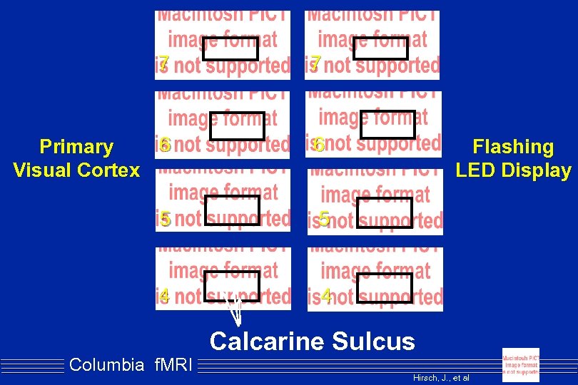 7 7 6 Primary Visual Cortex 6 5 5 4 4 Columbia f. MRI