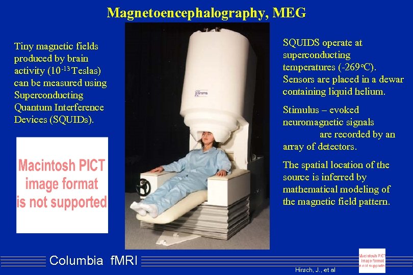 Magnetoencephalography, MEG Tiny magnetic fields produced by brain activity (10 -13 Teslas) can be