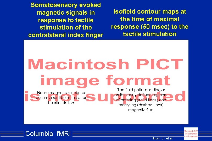 Somatosensory evoked magnetic signals in response to tactile stimulation of the contralateral index finger