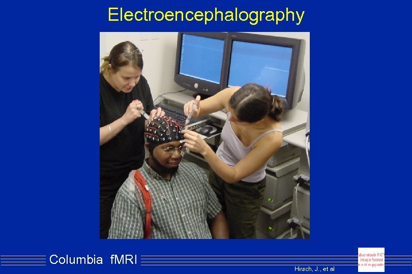 Electroencephalography Columbia f. MRI Hirsch, J. , et al 