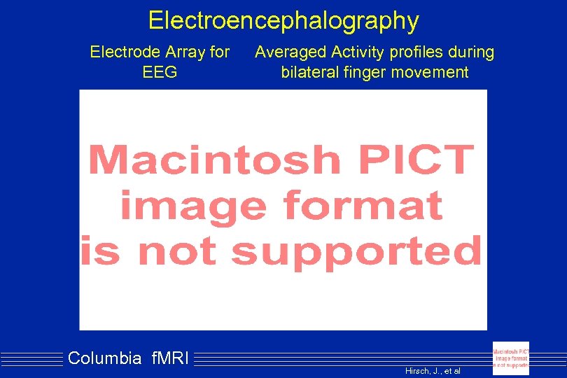 Electroencephalography Electrode Array for EEG Columbia f. MRI Averaged Activity profiles during bilateral finger