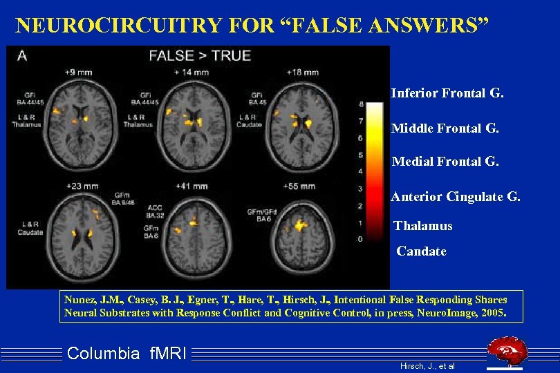 NEUROCIRCUITRY FOR “FALSE ANSWERS” Inferior Frontal G. Middle Frontal G. Medial Frontal G. Anterior