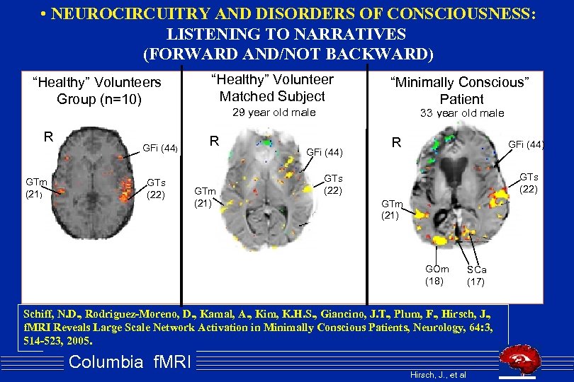  • NEUROCIRCUITRY AND DISORDERS OF CONSCIOUSNESS: LISTENING TO NARRATIVES (FORWARD AND/NOT BACKWARD) “Healthy”