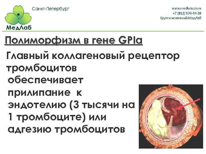 Полиморфизм в гене GPIa Главный коллагеновый рецептор тромбоцитов обеспечивает прилипание к эндотелию (3 тысячи
