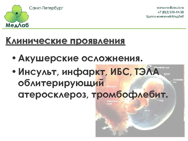 Клинические проявления • Акушерские осложнения. • Инсульт, инфаркт, ИБС, ТЭЛА облитерирующий атеросклероз, тромбофлебит. 