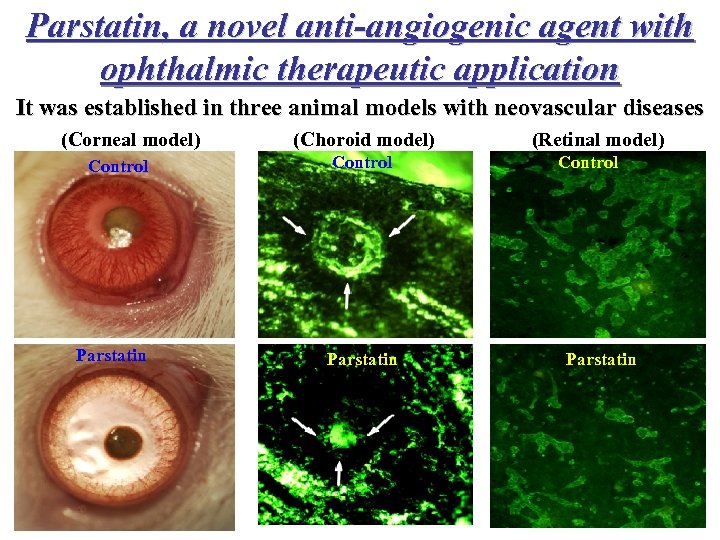 Parstatin, a novel anti-angiogenic agent with ophthalmic therapeutic application It was established in three
