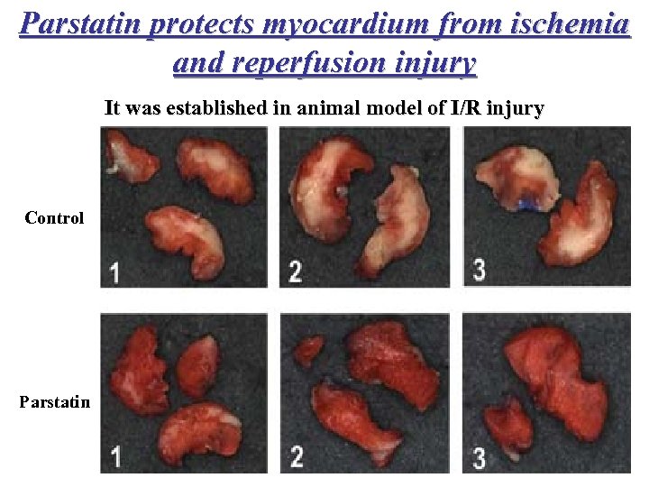 Parstatin protects myocardium from ischemia and reperfusion injury It was established in animal model