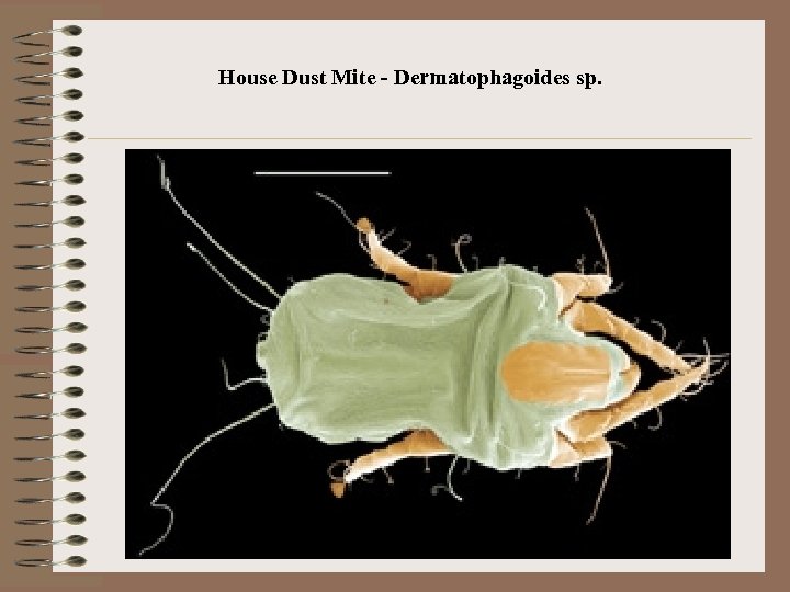 House Dust Mite - Dermatophagoides sp. 