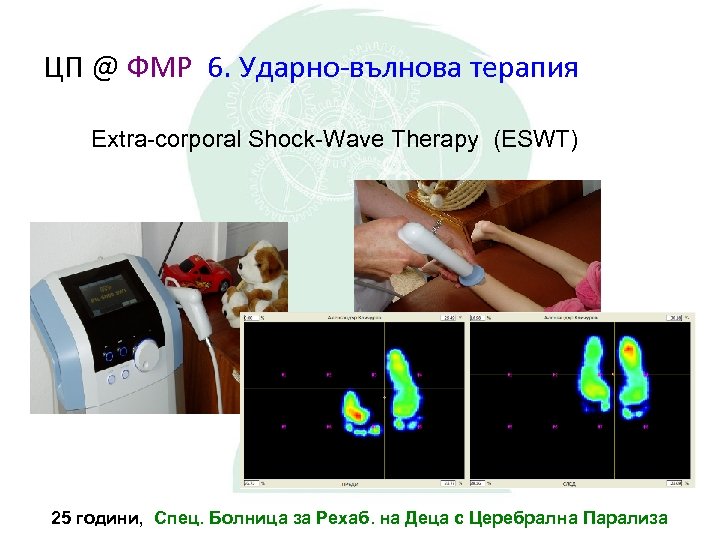 ЦП @ ФМР 6. Ударно-вълнова терапия Extra-corporal Shock-Wave Therapy (ESWT) 25 години, Спец. Болница
