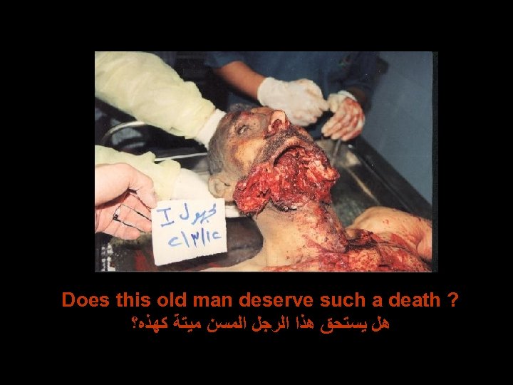 Does this old man deserve such a death ? ﻫﻞ ﻳﺴﺘﺤﻖ ﻫﺬﺍ ﺍﻟﺮﺟﻞ ﺍﻟﻤﺴﻦ