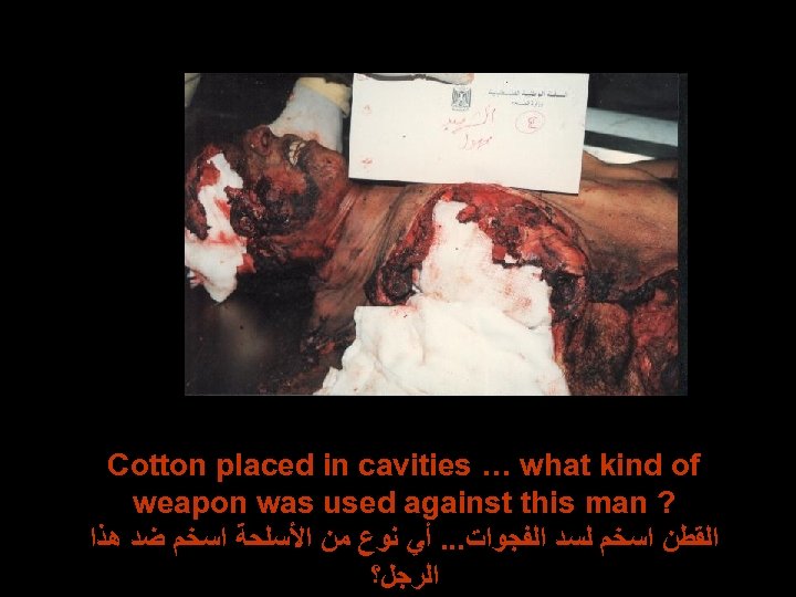 Cotton placed in cavities … what kind of weapon was used against this man