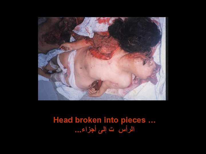 Head broken into pieces …. . . ﺍﻟﺮﺃﺲ ﺕ ﺇﻟﻰ ﺃﺠﺰﺍﺀ 