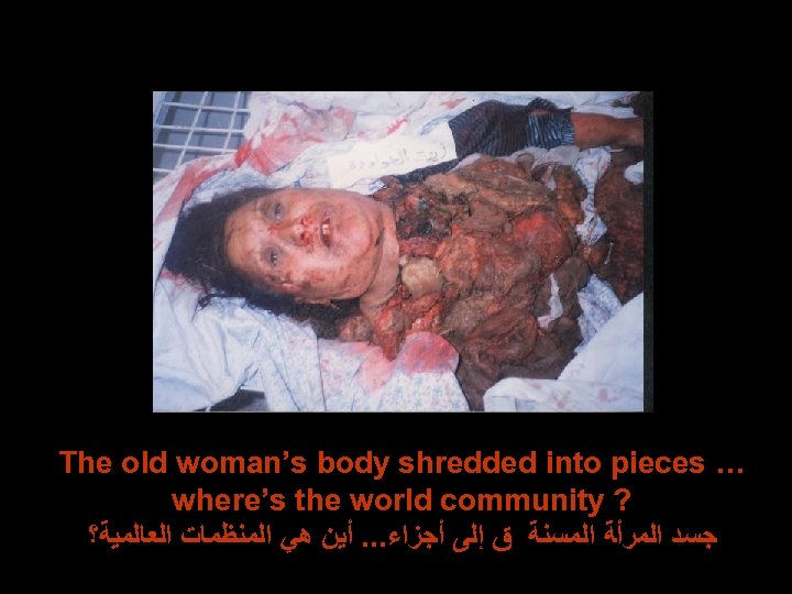 The old woman’s body shredded into pieces … where’s the world community ? ﺟﺴﺪ